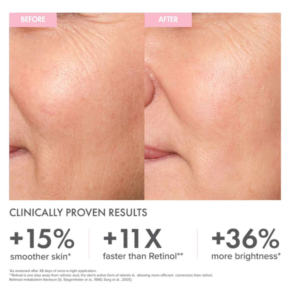 The Organic Pharmacy Retinal Renewal Night Serum – Produktgrafik vorher/nachher