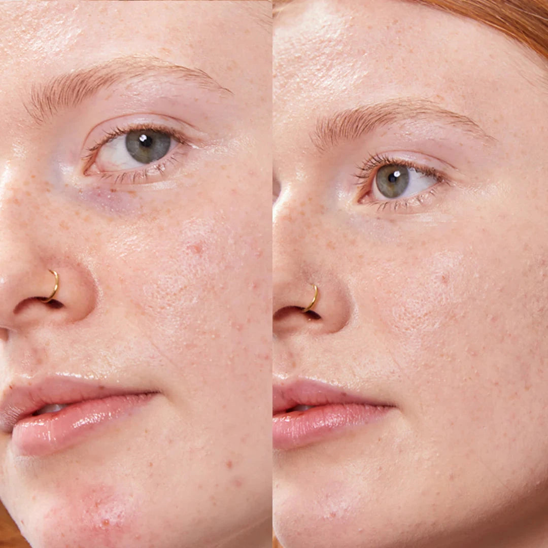 Concealer Balm - pflegender Concealer Stick von PURE U. Cosmetics