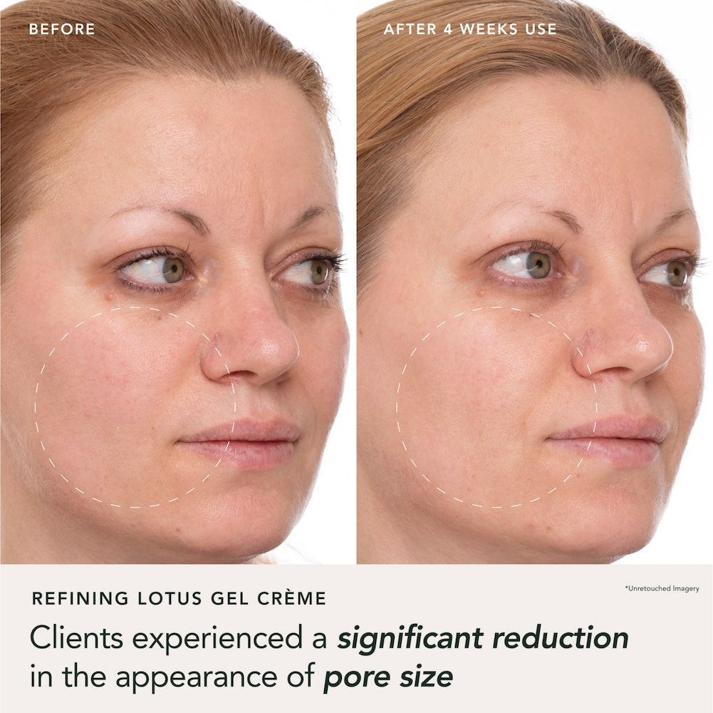 RANAVAT Refining Lotus Gel Crème - IMPERIAL GLOW