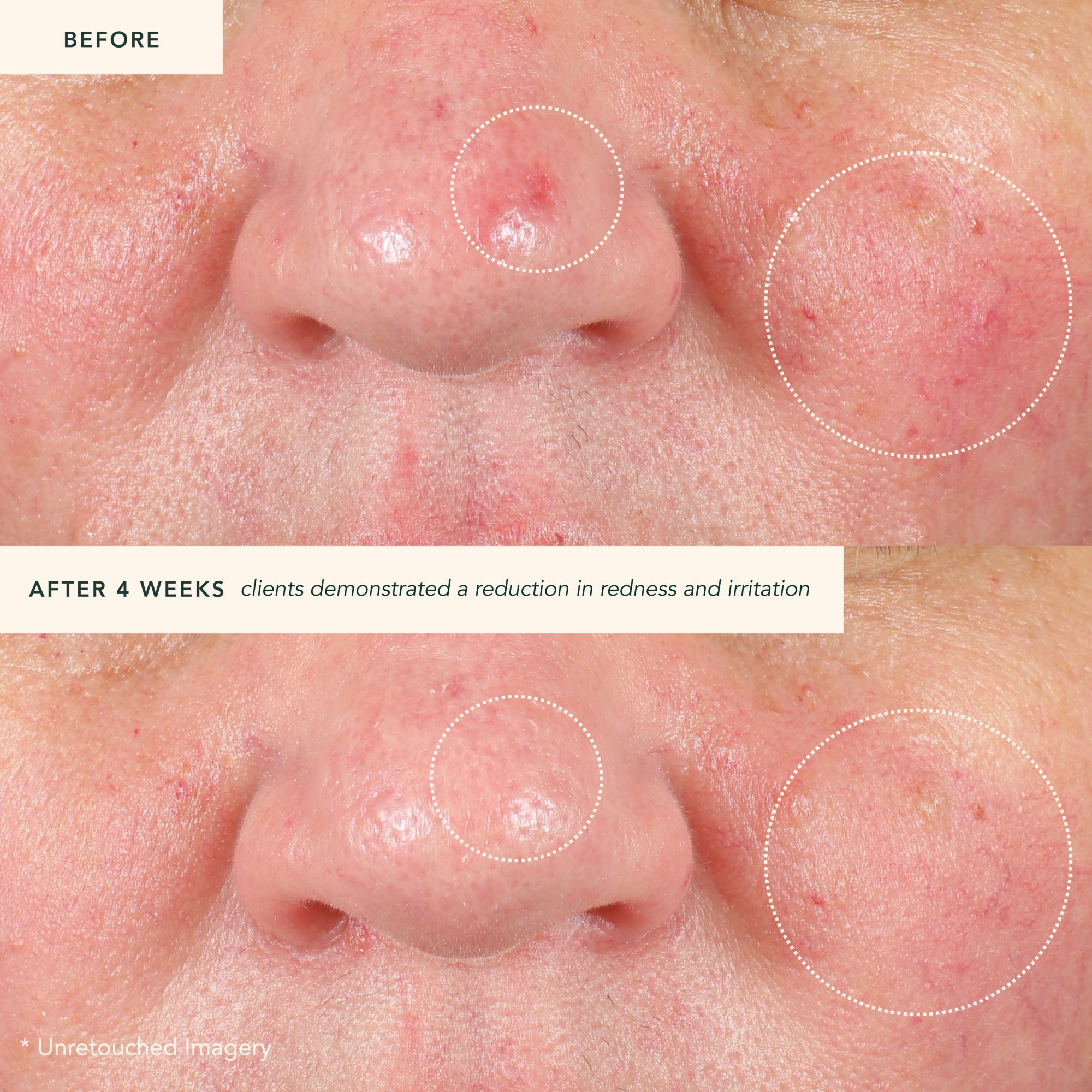 Restoring Moonseed Treatment - Ayurvedischer Balm für Feuchtigkeit und Hautberuhigung