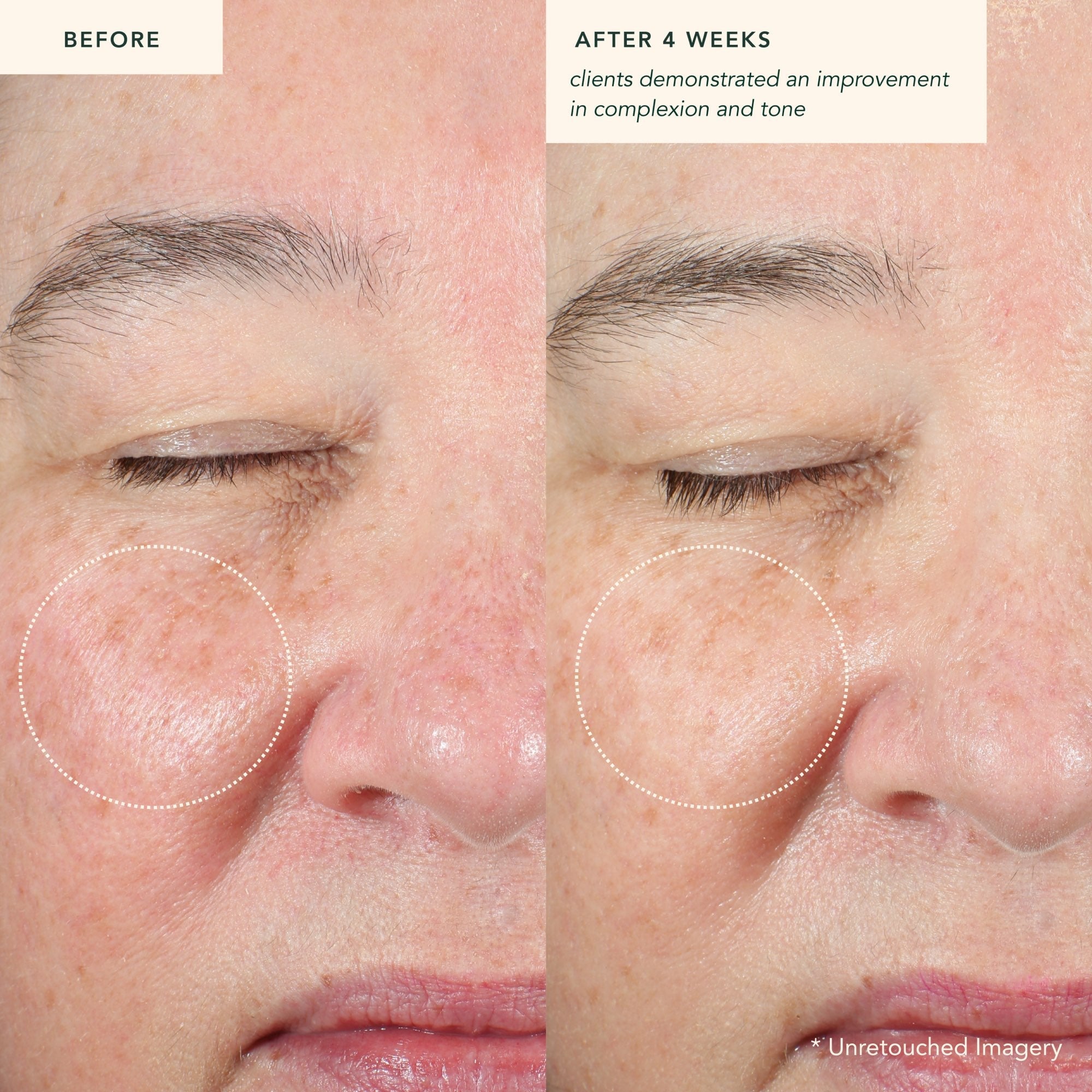 Restoring Moonseed Treatment - Ayurvedischer Balm für Feuchtigkeit und Hautberuhigung