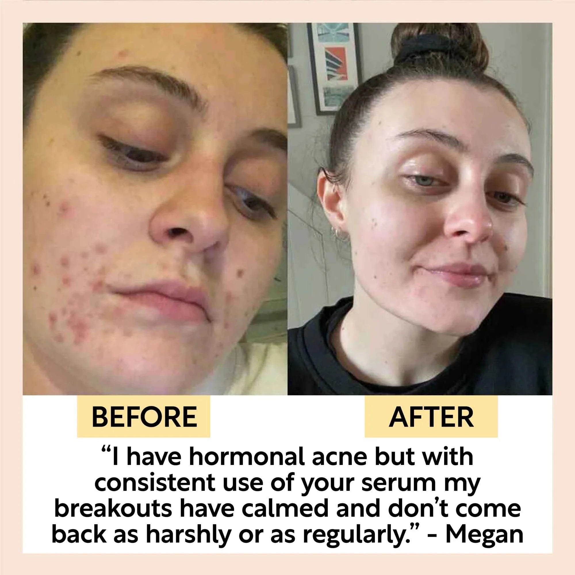 Organic Face Oil mit Kaffeeöl, Sanddorn und Antioxidantien von UpCircle (30ml)