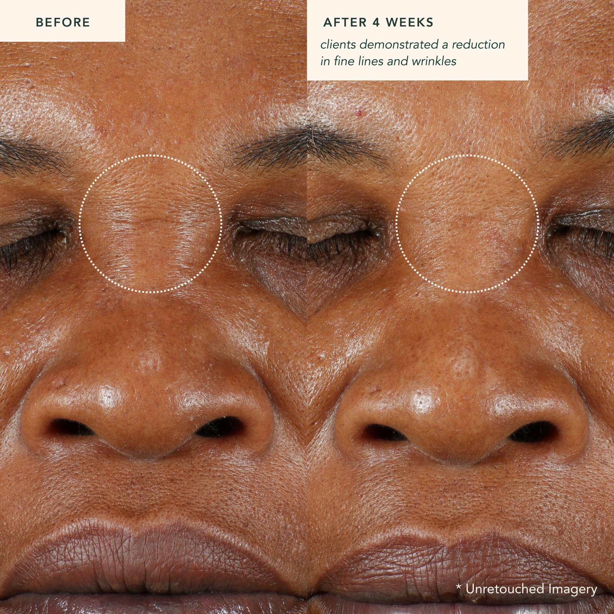 Restoring Moonseed Treatment - Ayurvedischer Balm für Feuchtigkeit und Hautberuhigung