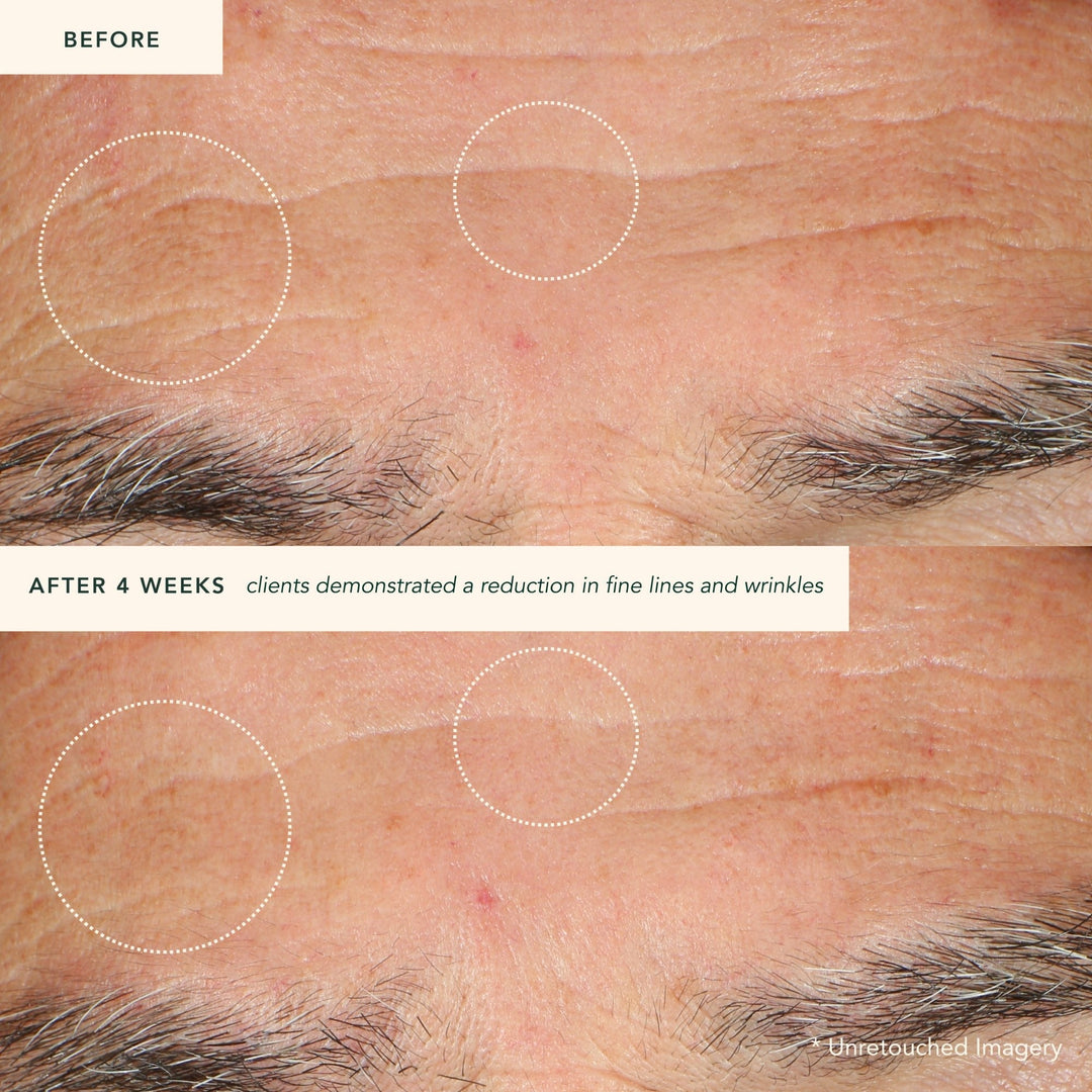 Restoring Moonseed Treatment - Ayurvedischer Balm für Feuchtigkeit und Hautberuhigung North Glow
