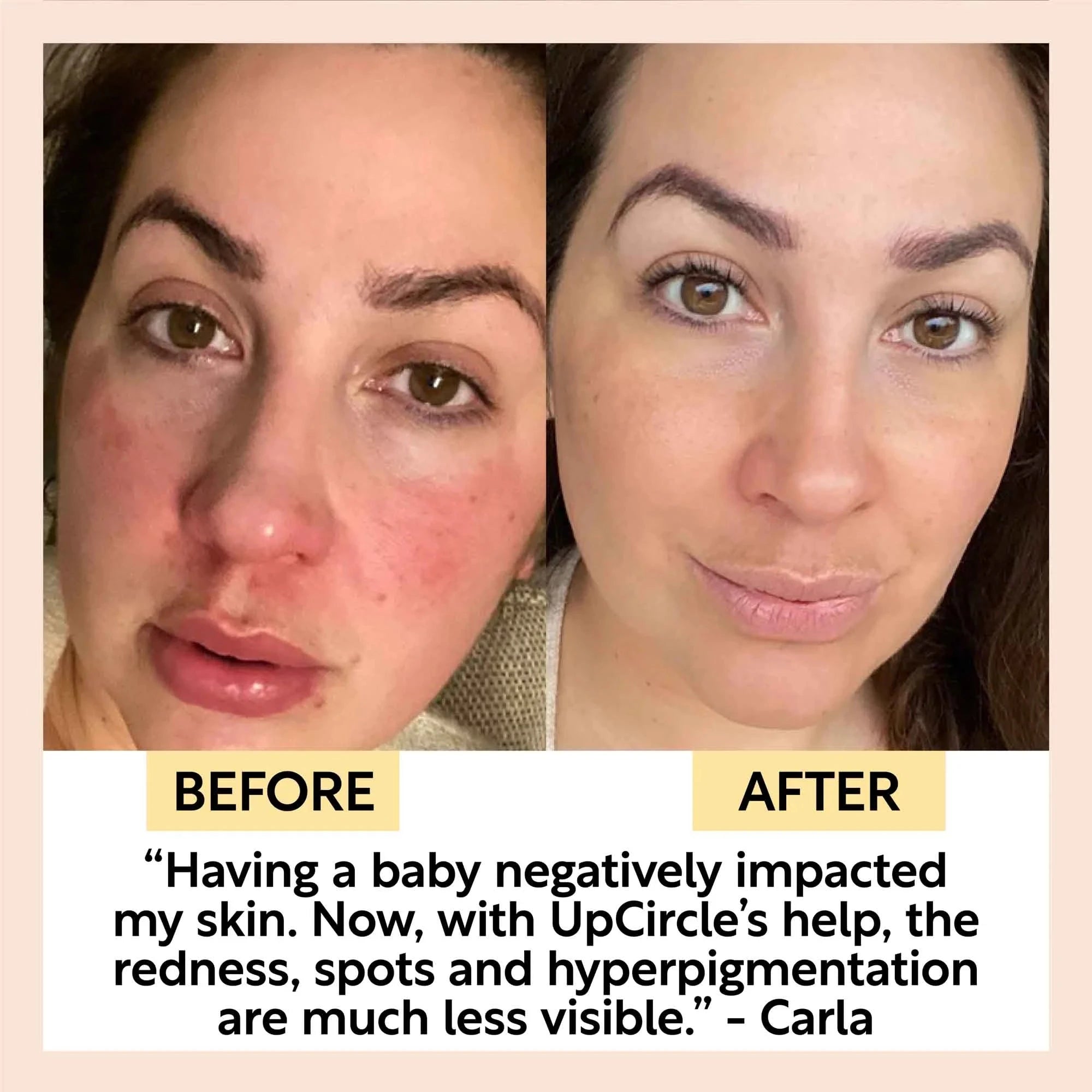 Organic Face Oil mit Kaffeeöl, Sanddorn und Antioxidantien von UpCircle (30ml)