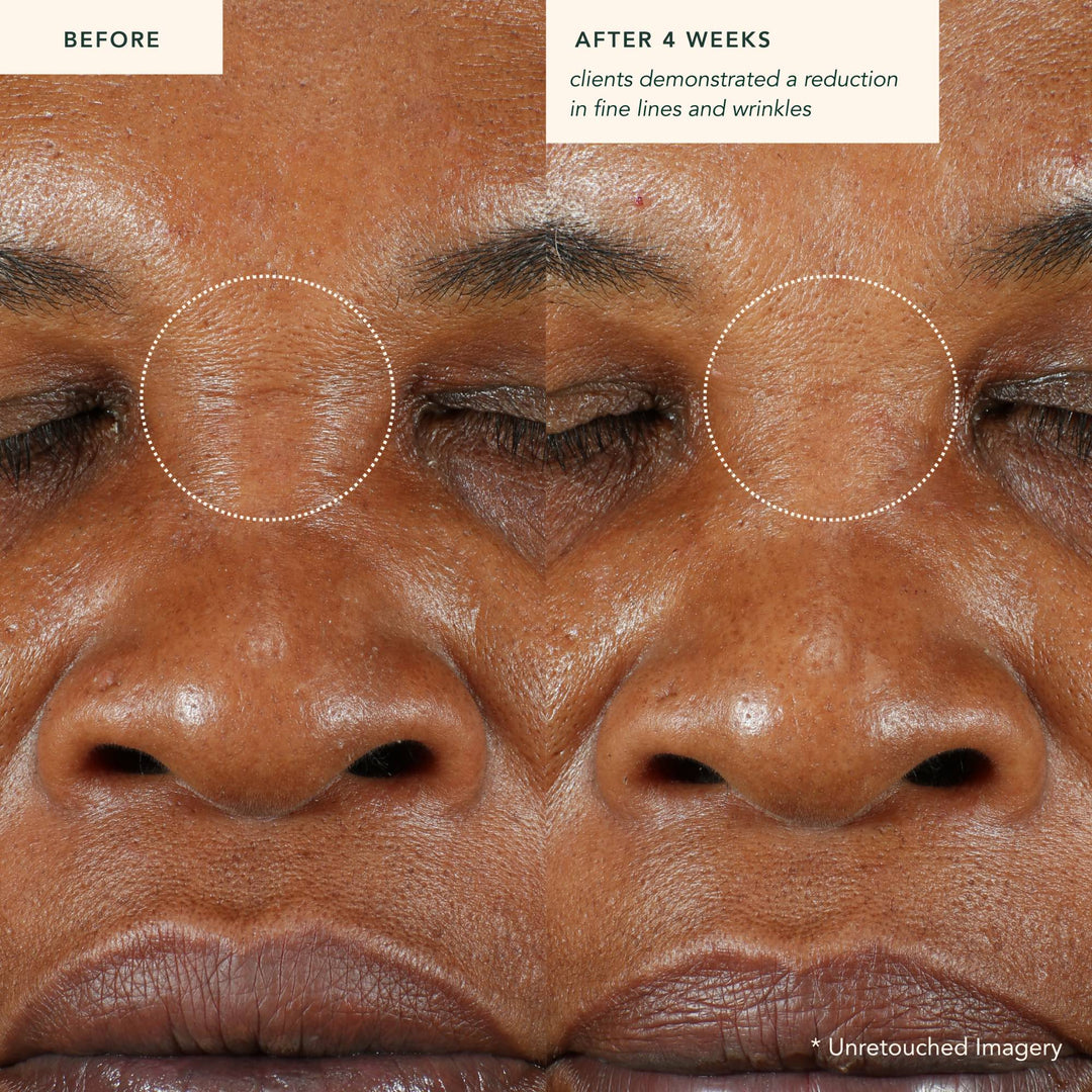 Restoring Moonseed Treatment - Ayurvedic Balm for Moisture and Skin Soothing North Glow