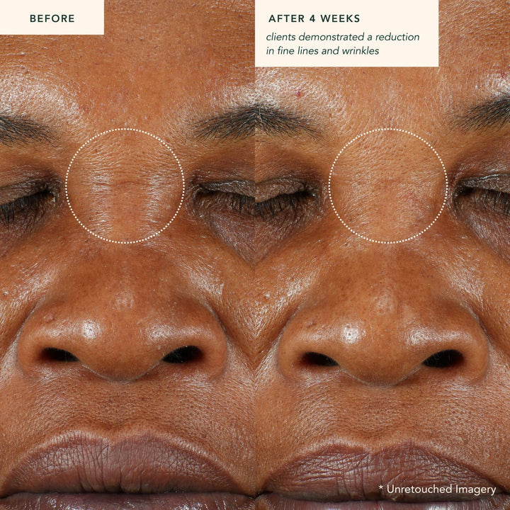Restoring Moonseed Treatment - Ayurvedic Balm for Moisture and Soothing Skin
